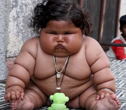 仰天ニュースのインドのキロ巨大赤ちゃんがやばい 肥満の原因は食欲か病気 画像も Yoshikiのトレンド速報