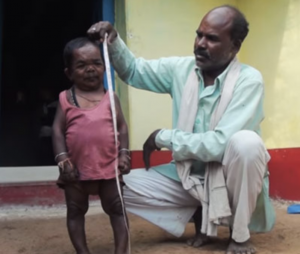世界仰天ニュース！インドのバソーリ・ラルは身長73センチのおじちゃん！病気の原因や画像は？
